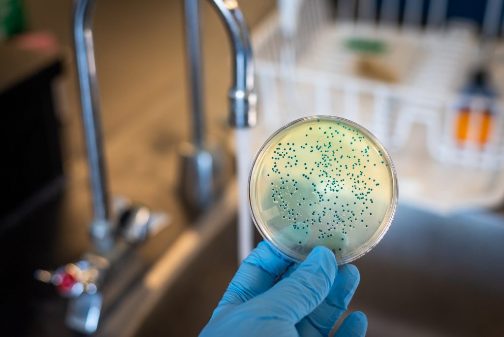 How to Detect Contaminants in Your Water Supply How to Detect Contaminants in Your Water Supply